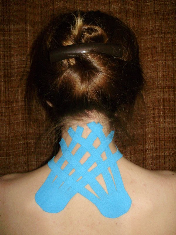Blue kinesiology tape applied across the back of the neck